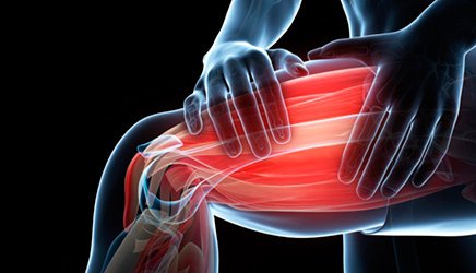 Delayed Onset Muscle Soreness